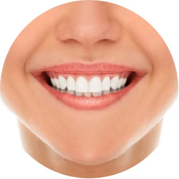 Professional Teeth Whitening Service at Bonita Laser in Mississauga