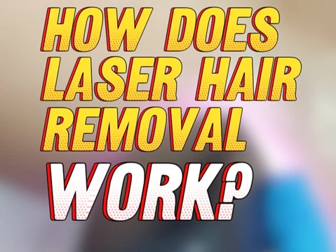 How Laser Hair Removal Works