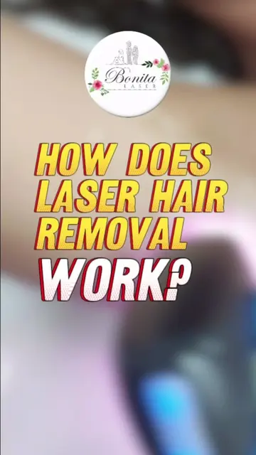 How Does Laser Hair Removal Work? | Soprano Laser Technology Explained